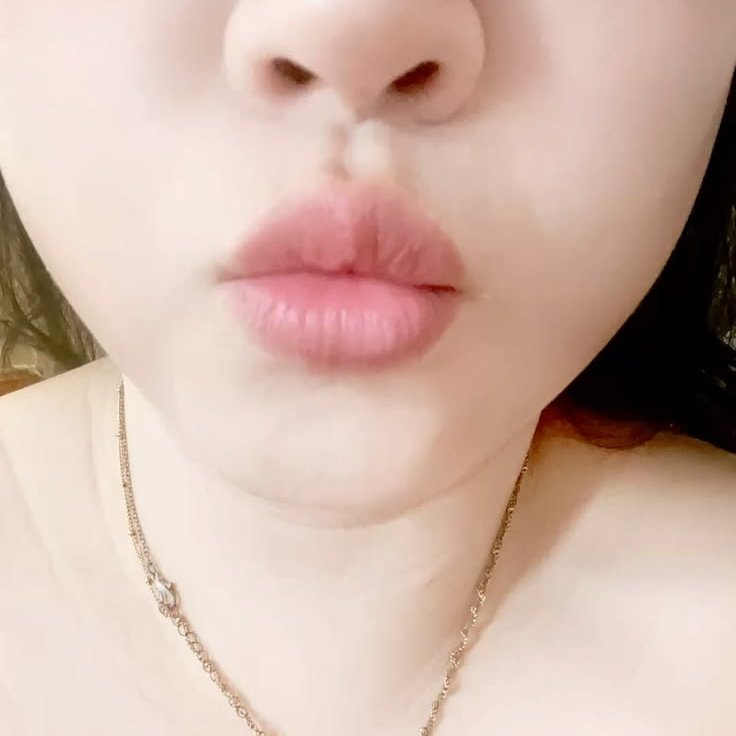 Live Video
